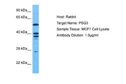 PSG3 Rabbit anti-Human, Polyclonal, Novus Biologicals 0.1ml; Unconjugated:Antibodies,